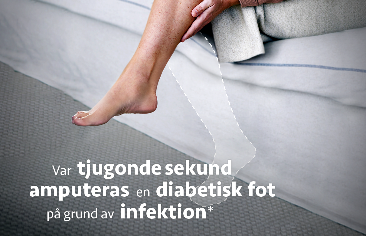 Ett ben med markerad kontur av en amputerad fot. Text i bild: Var tjugonde sekund amputeras en diabetisk fot på grund av infektion*