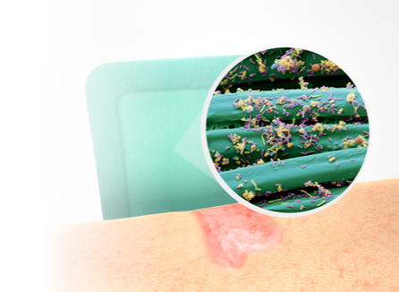 illustration showing a wound, Sorbact Superabsorbent and a microscopic image with microbes on a Sorbact surface